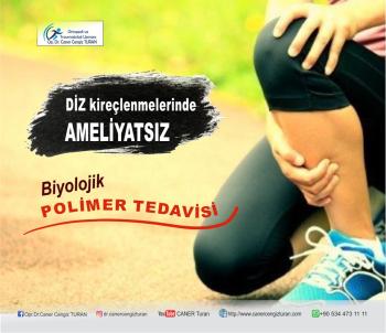 Polimer yağlayıcı diz cerrahisinin yerine geçebilir!